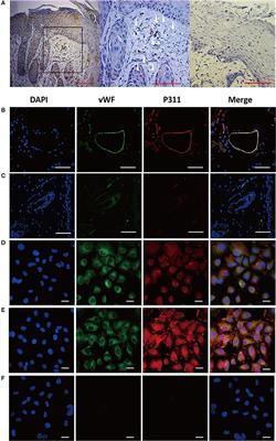 P311 Deficiency Leads to Attenuated Angiogenesis in Cutaneous Wound Healing